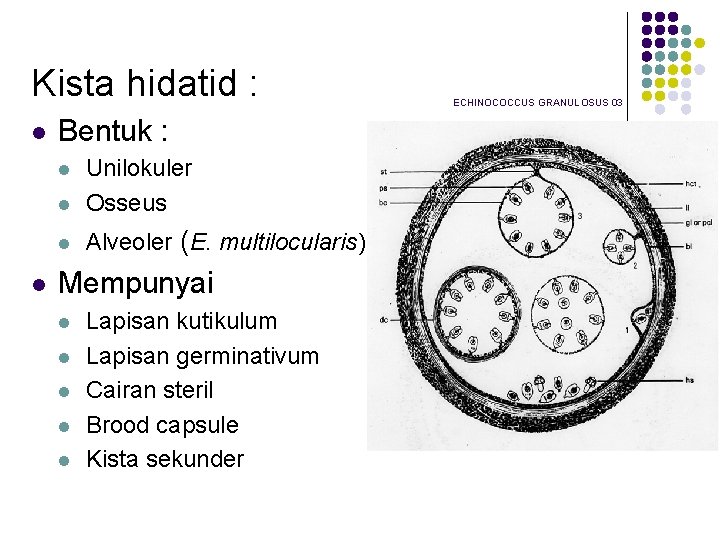 Kista hidatid : l Bentuk : l Unilokuler Osseus l Alveoler (E. multilocularis) l