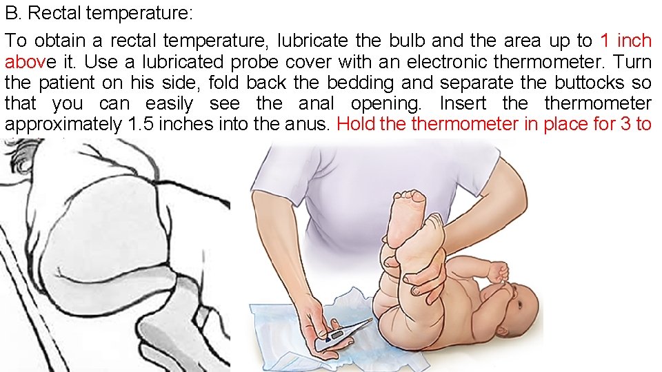 B. Rectal temperature: To obtain a rectal temperature, lubricate the bulb and the area
