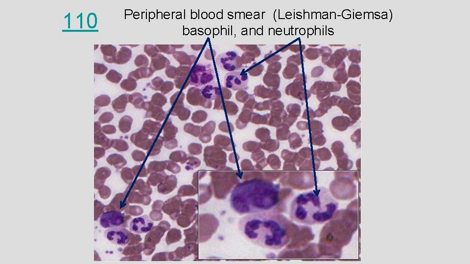 110 Peripheral blood smear (Leishman-Giemsa) basophil, and neutrophils 