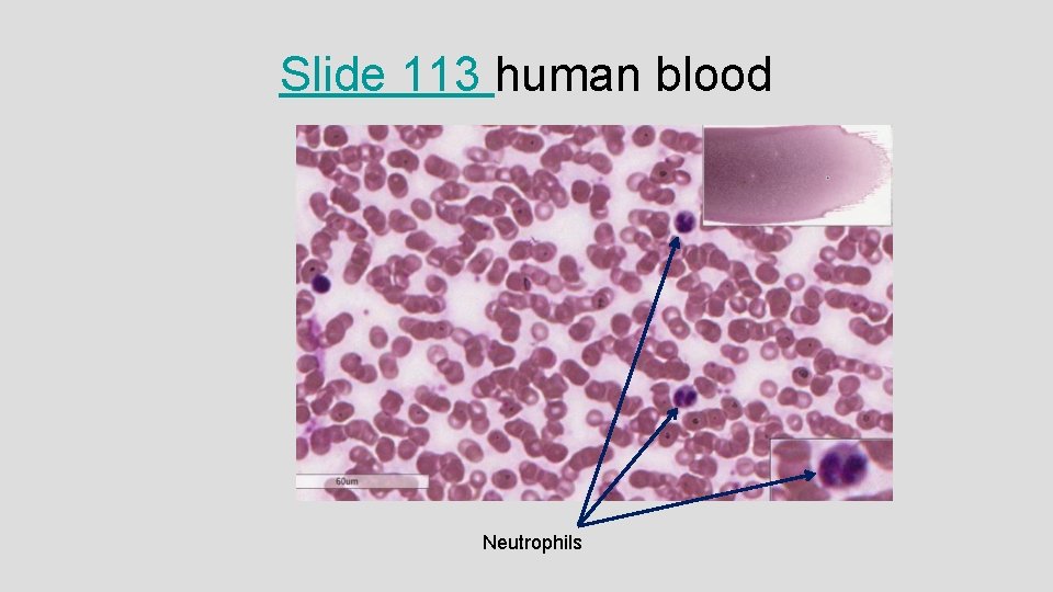 Slide 113 human blood Neutrophils 