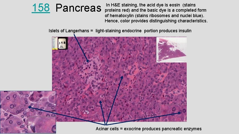 158 Pancreas In H&E staining, the acid dye is eosin (stains proteins red) and