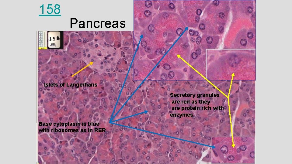 158 Pancreas Islets of Langerhans Secretory granules are red as they are protein rich