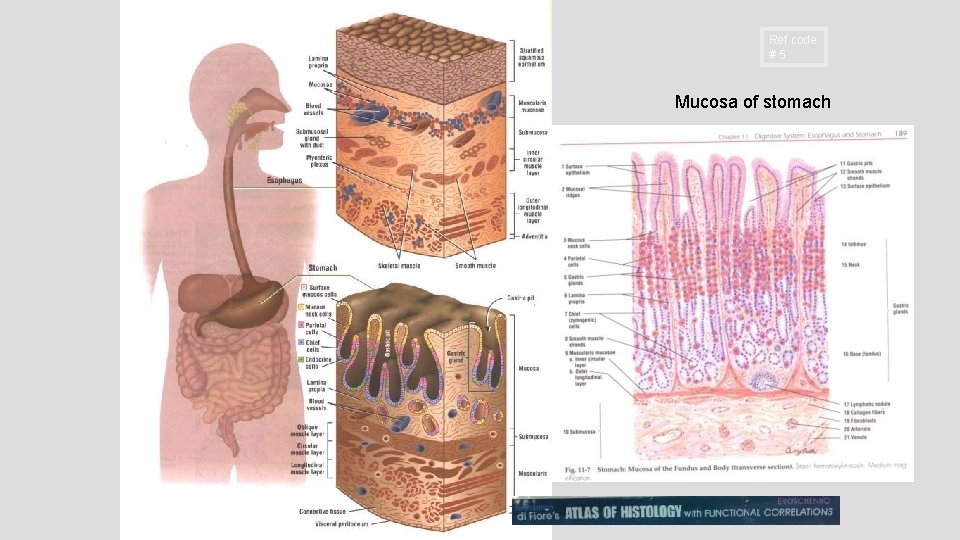 Ref code #5 Mucosa of stomach 