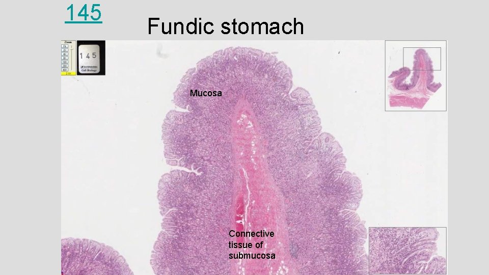 145 Fundic stomach Mucosa Connective tissue of submucosa 