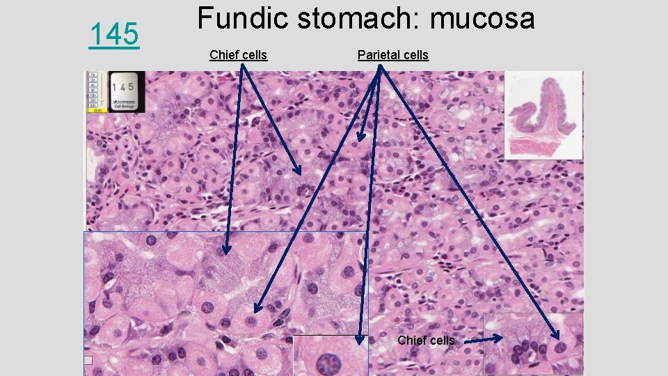 145 Fundic stomach: mucosa Chief cells Parietal cells Chief cells 