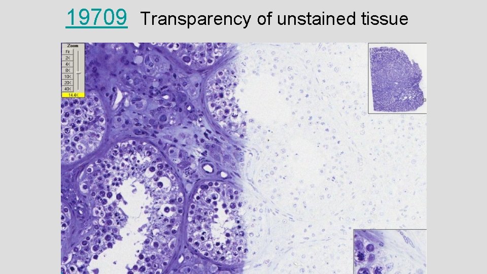 19709 Transparency of unstained tissue 