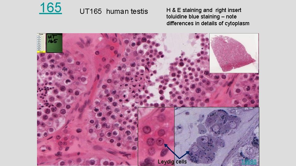 165 UT 165 human testis H & E staining and right insert toluidine blue