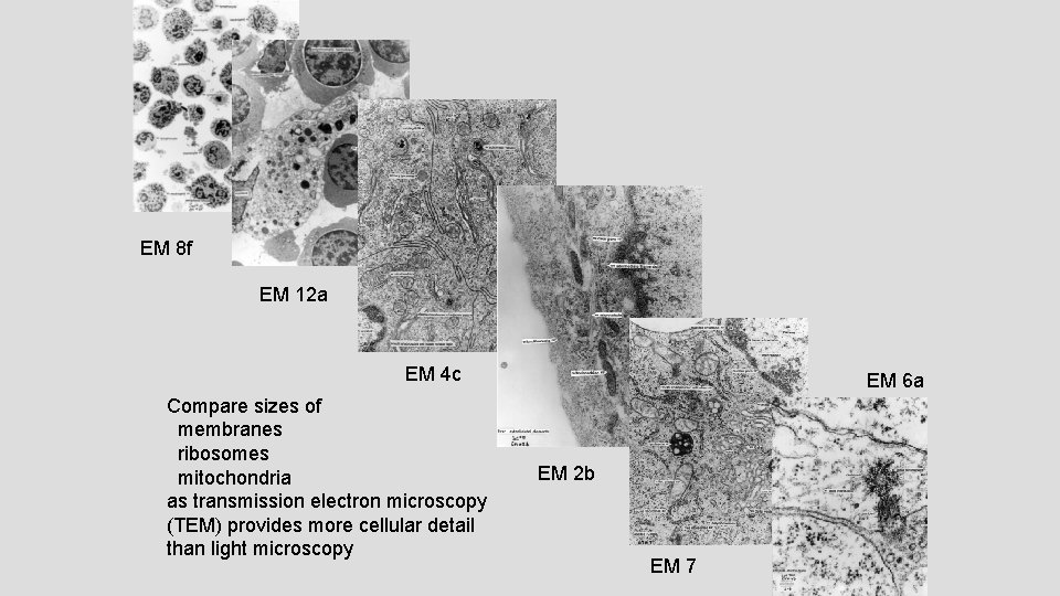 EM 8 f EM 12 a EM 4 c Compare sizes of membranes ribosomes