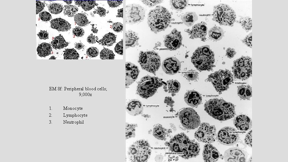 EM 8 f: Peripheral blood cells; 9, 000 x 1. 2. 3. Monocyte Lymphocyte