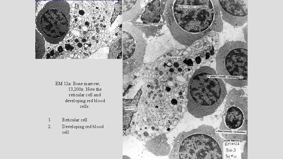 EM 12 a: Bone marrow; 13, 200 x. Note the reticular cell and developing