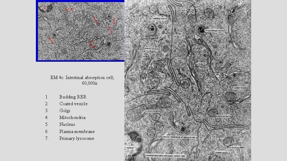 EM 4 c: Intestinal absorption cell; 60, 000 x 1. 2. 3. 4. 5.