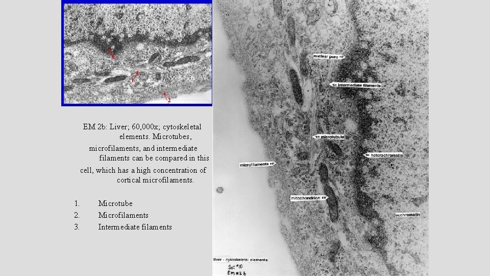 EM 2 b: Liver; 60, 000 x; cytoskeletal elements. Microtubes, microfilaments, and intermediate filaments