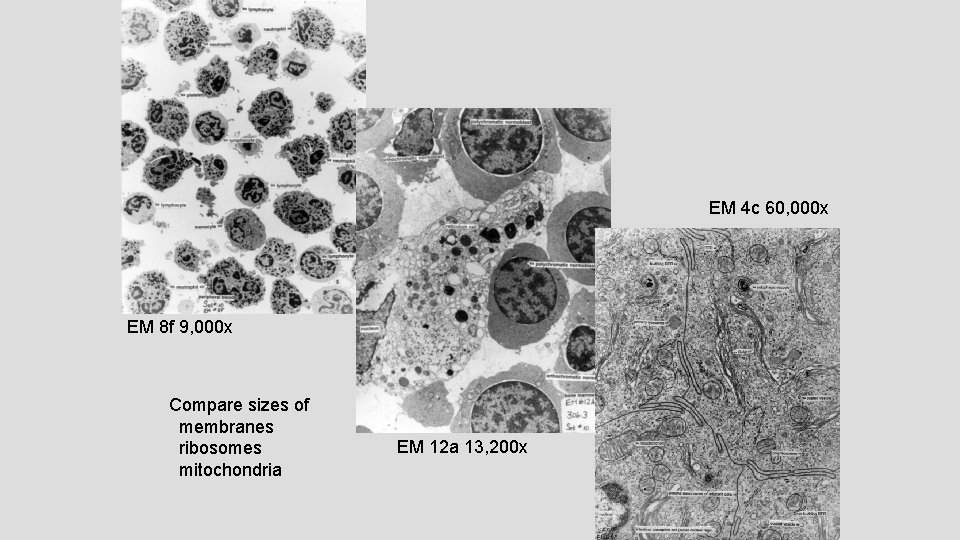 EM 4 c 60, 000 x EM 8 f 9, 000 x Compare sizes