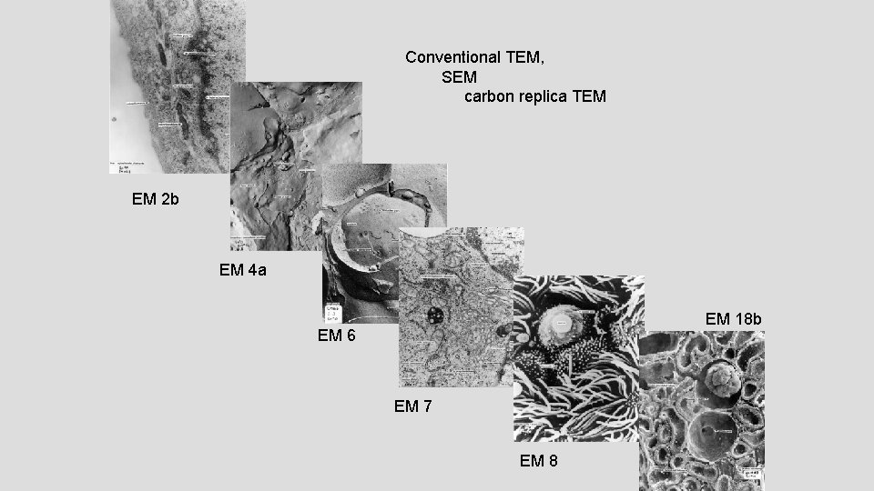 Conventional TEM, SEM carbon replica TEM EM 2 b EM 4 a EM 18