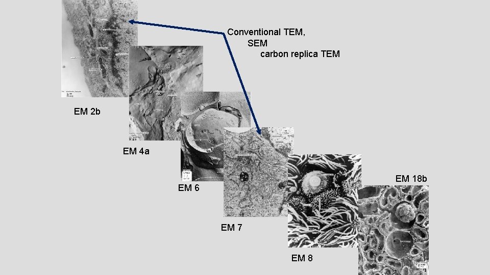 Conventional TEM, SEM carbon replica TEM EM 2 b EM 4 a EM 18