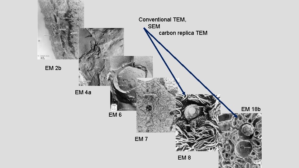 Conventional TEM, SEM carbon replica TEM EM 2 b EM 4 a EM 18