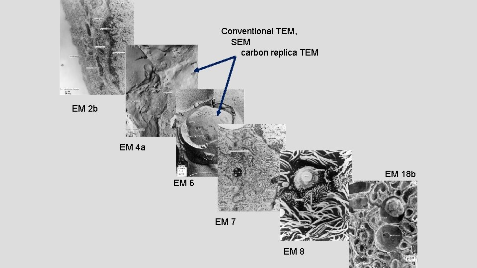 Conventional TEM, SEM carbon replica TEM EM 2 b EM 4 a EM 18