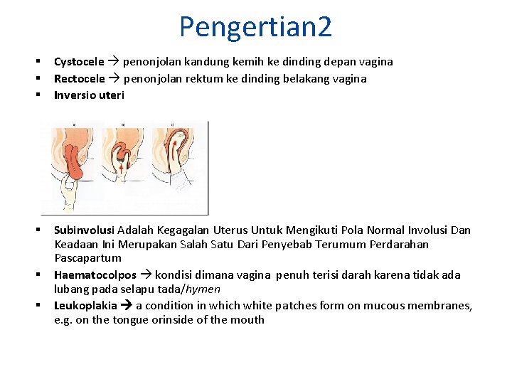 Pengertian 2 Cystocele penonjolan kandung kemih ke dinding depan vagina Rectocele penonjolan rektum ke
