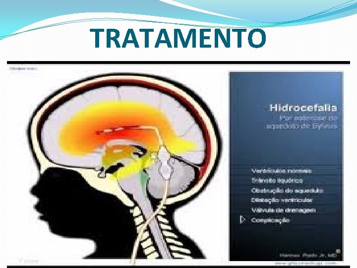 TRATAMENTO 