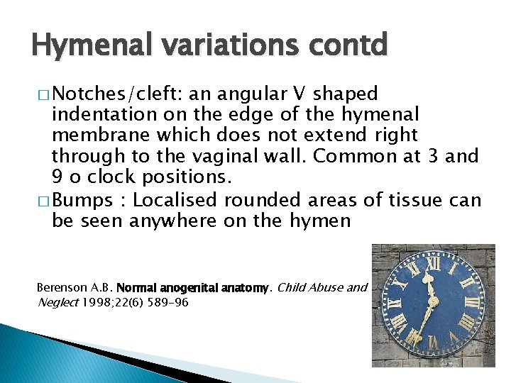 Hymenal variations contd � Notches/cleft: an angular V shaped indentation on the edge of