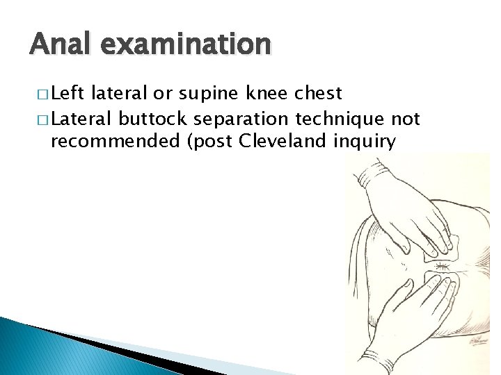 Anal examination � Left lateral or supine knee chest � Lateral buttock separation technique