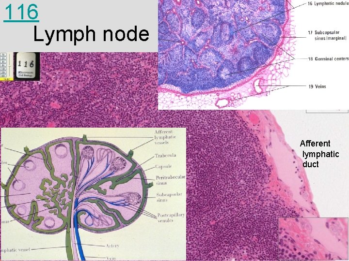 116 Lymph node Afferent lymphatic duct 