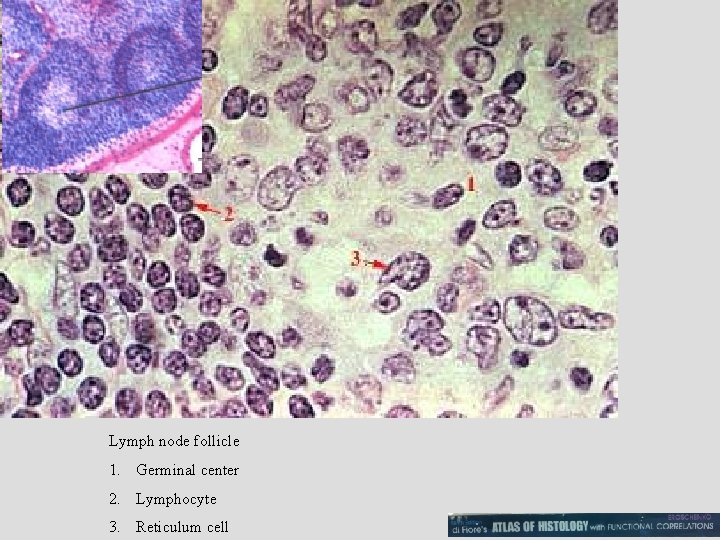 Lymph node follicle 1. Germinal center 2. Lymphocyte 3. Reticulum cell 