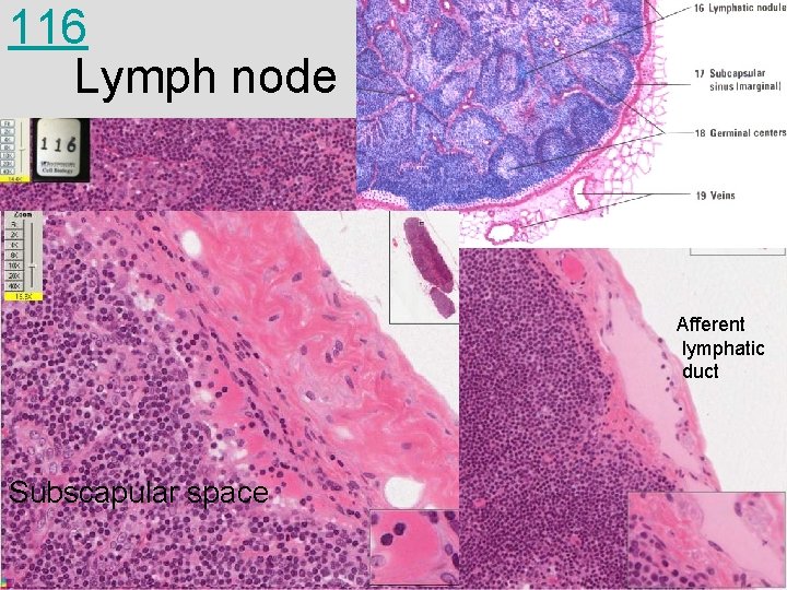 116 Lymph node Afferent lymphatic duct Subscapular space 