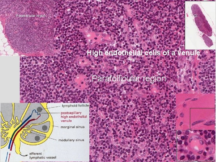 Parafollicular region High endothelial cells of a venule Parafollicular region 