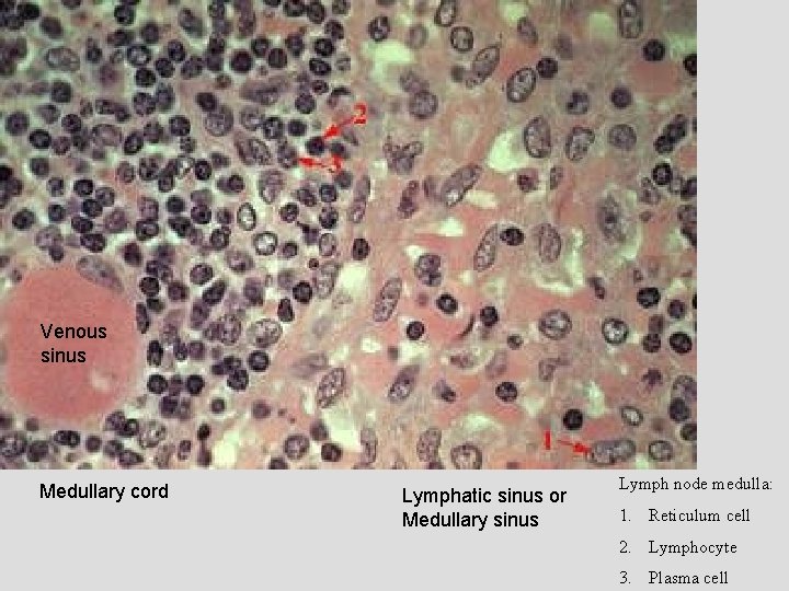 Venous sinus Medullary cord Lymphatic sinus or Medullary sinus Lymph node medulla: 1. Reticulum