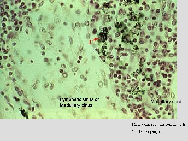 Lymphatic sinus or Medullary sinus Macrophages in the lymph node m 1. Macrophages 