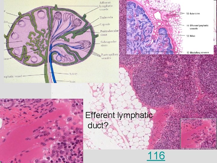 Efferent lymphatic duct? 116 