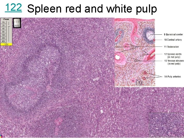 122 Spleen red and white pulp 