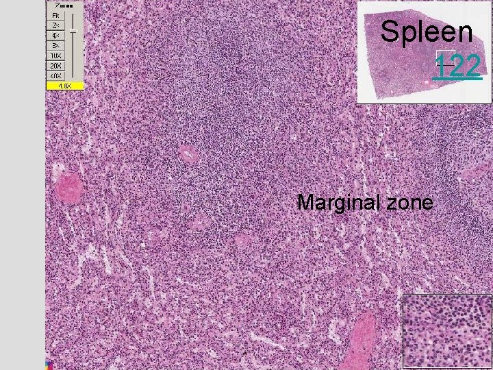 Spleen 122 Marginal zone 