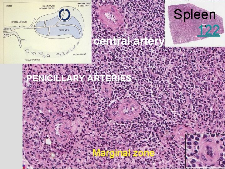 central artery PENICILLARY ARTERIES Marginal zone Spleen 122 