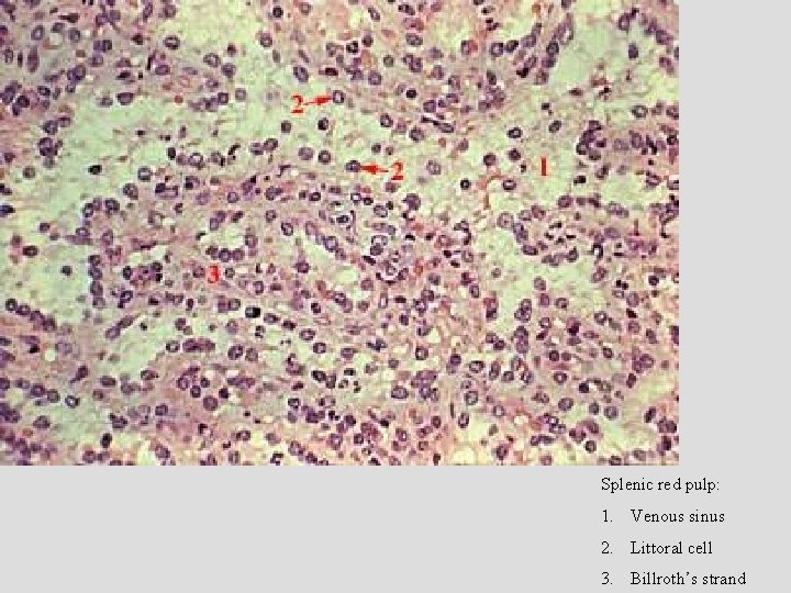 Splenic red pulp: 1. Venous sinus 2. Littoral cell 3. Billroth’s strand 