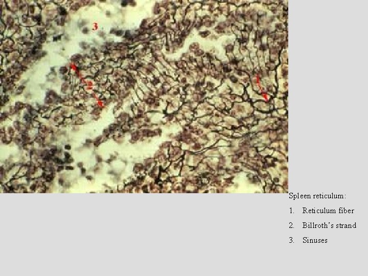 Spleen reticulum: 1. Reticulum fiber 2. Billroth’s strand 3. Sinuses 