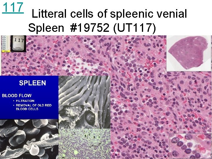 117 Litteral cells of spleenic venial Spleen #19752 (UT 117) 