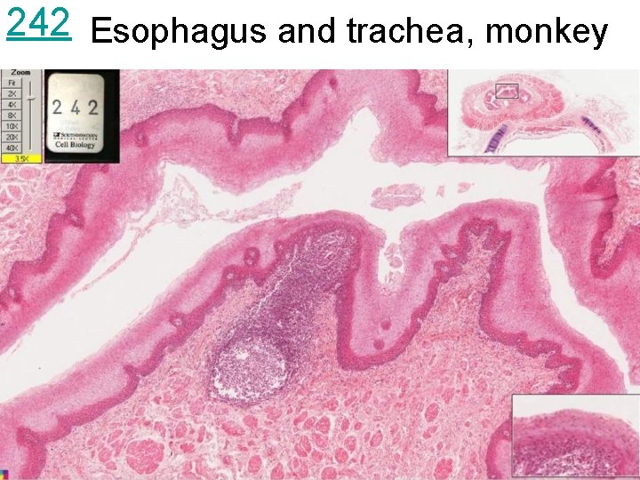 242 Esophagus and trachea, monkey 