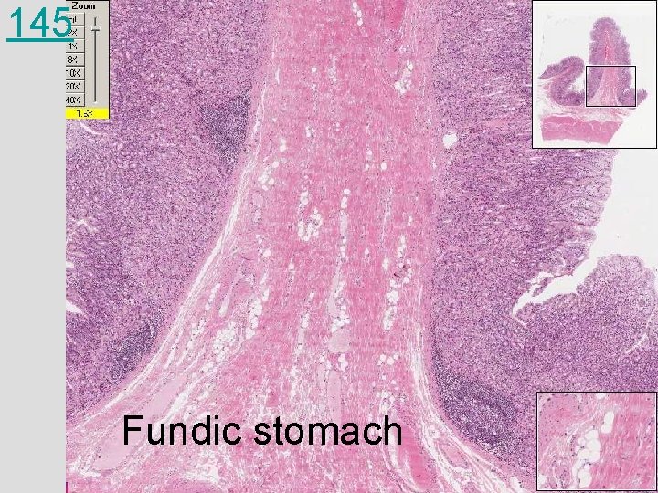 145 Fundic stomach 