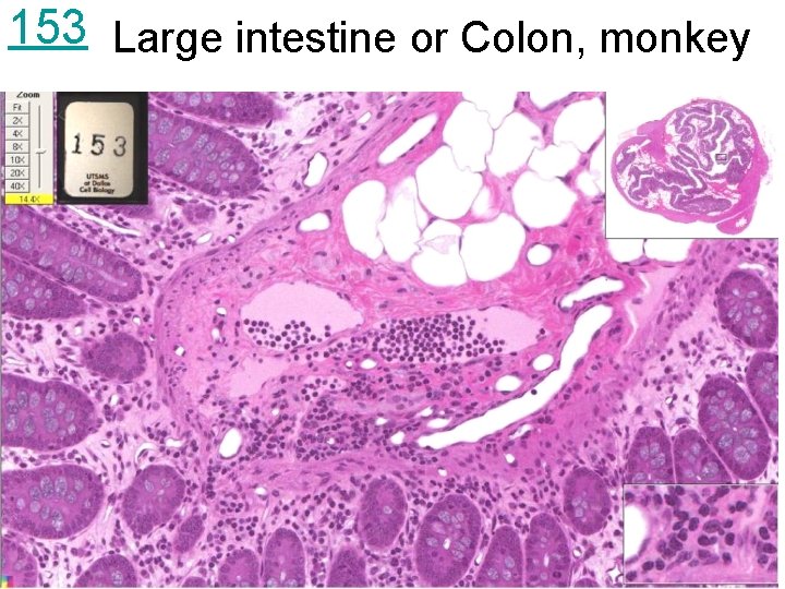 153 Large intestine or Colon, monkey 