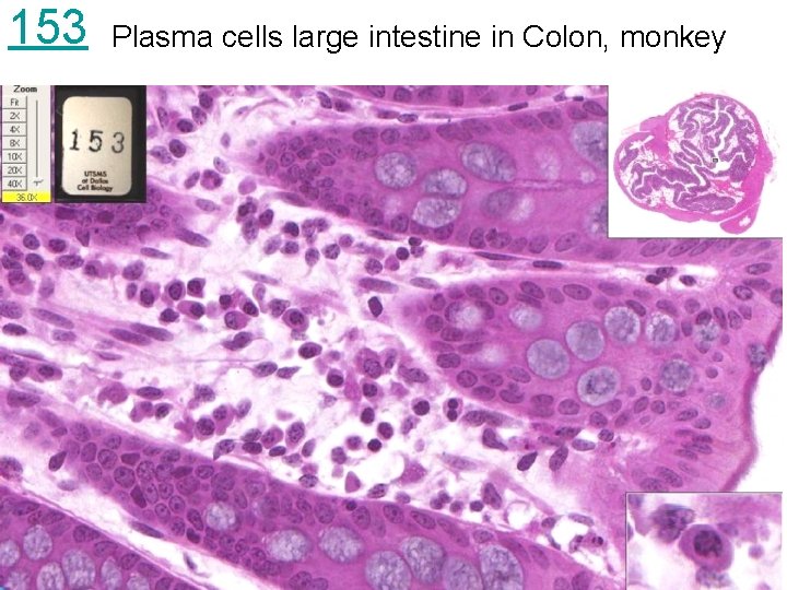 153 Plasma cells large intestine in Colon, monkey 