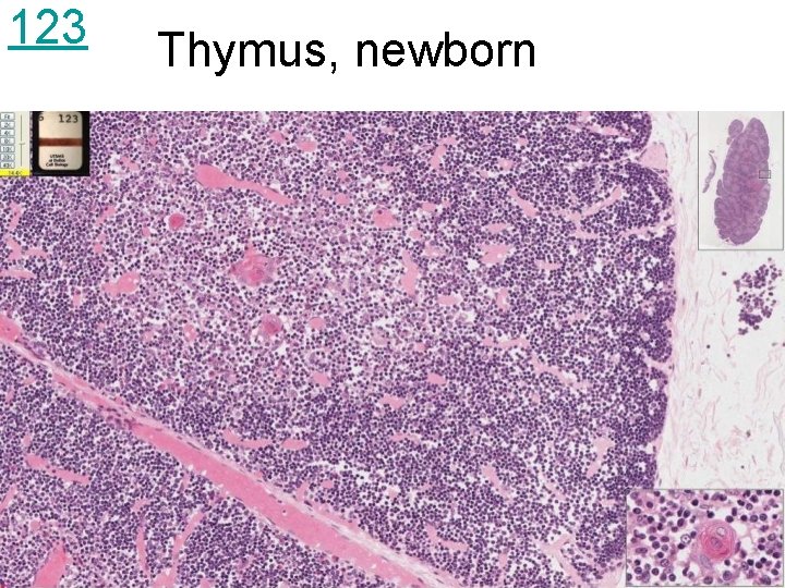 123 Thymus, newborn 