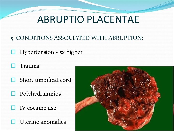ABRUPTIO PLACENTAE 5. CONDITIONS ASSOCIATED WITH ABRUPTION: � Hypertension - 5 x higher �