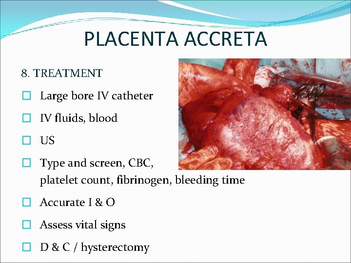 PLACENTA ACCRETA 8. TREATMENT � Large bore IV catheter � IV fluids, blood �