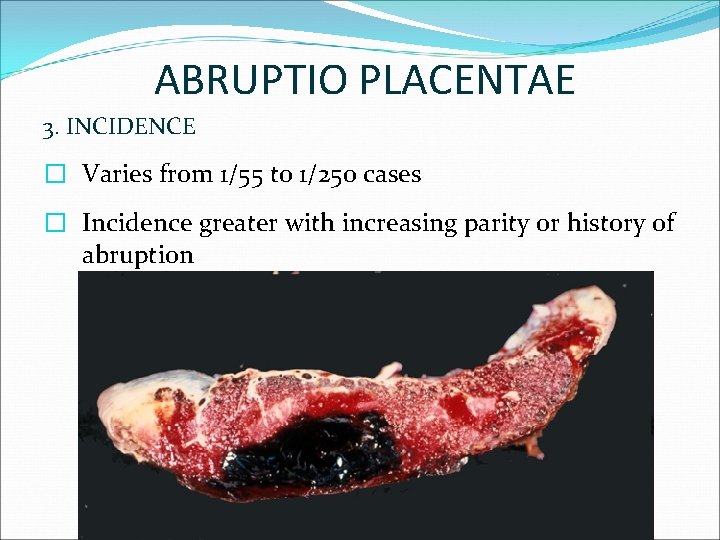 ABRUPTIO PLACENTAE 3. INCIDENCE � Varies from 1/55 to 1/250 cases � Incidence greater