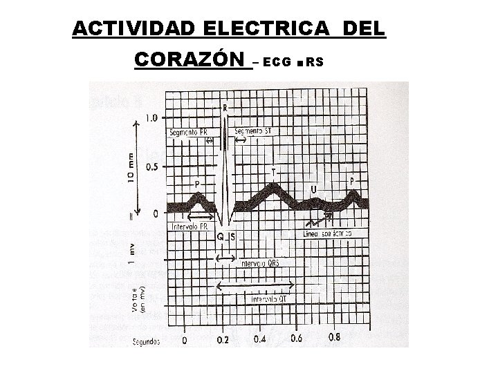 ACTIVIDAD ELECTRICA DEL CORAZÓN – ECG . RS 