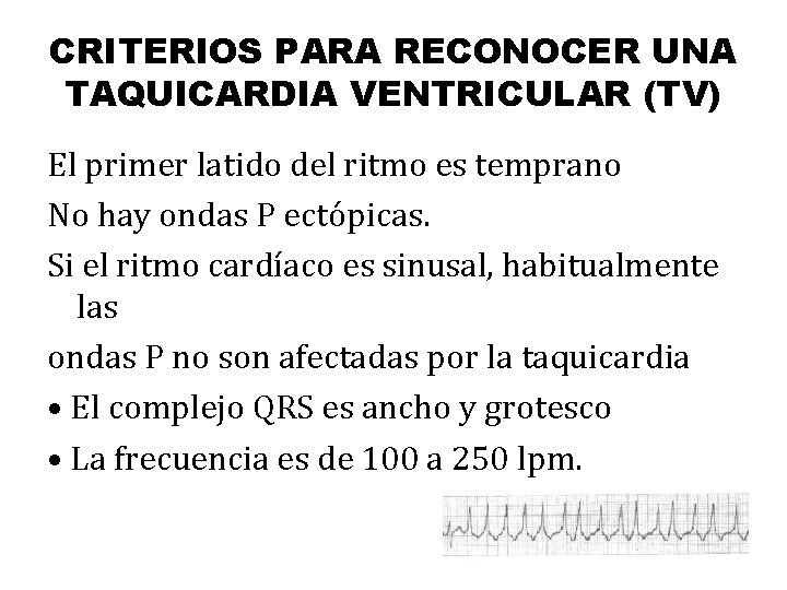 CRITERIOS PARA RECONOCER UNA TAQUICARDIA VENTRICULAR (TV) El primer latido del ritmo es temprano