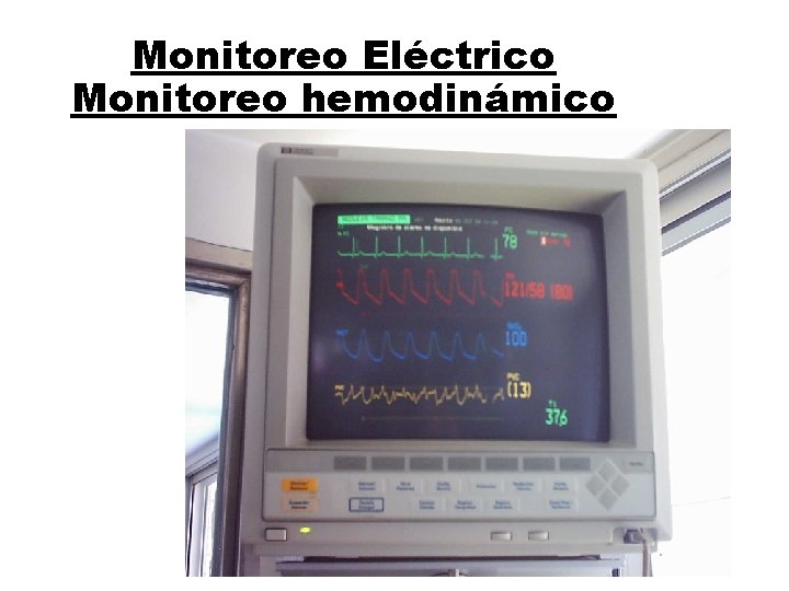 Monitoreo Eléctrico Monitoreo hemodinámico 