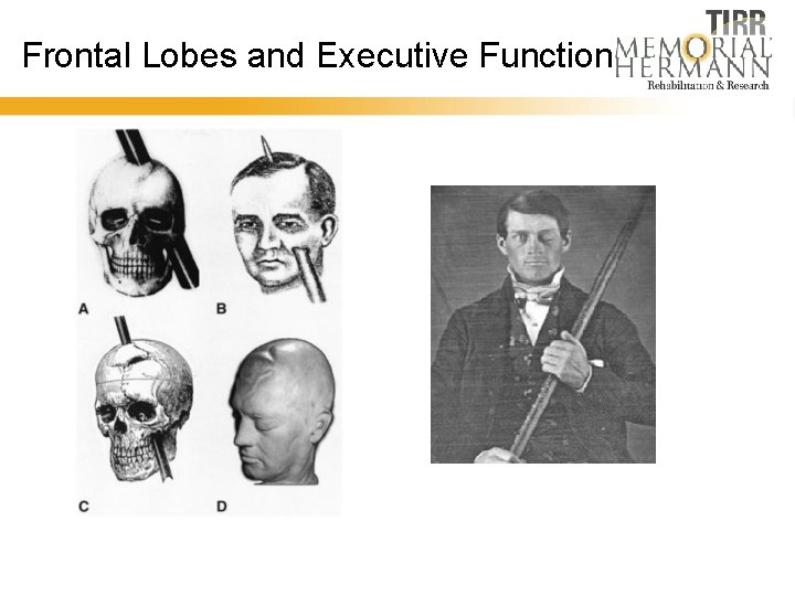Frontal Lobes and Executive Function 